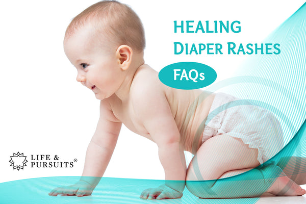 Healing Diaper Rashes – FAQs